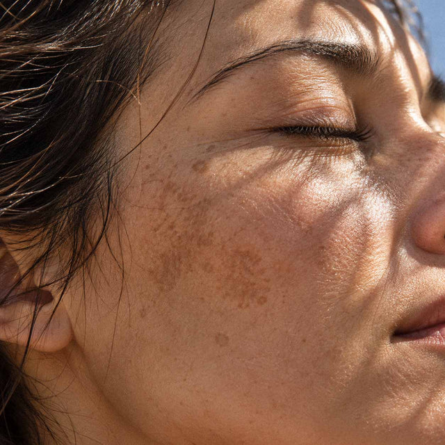 Visage d'une femme au soleil, taches pigmentaires sur la joue, exposome et vieillissement cutané
