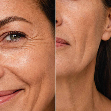 Diptyque de visages matures, rides du contour de l'œil et sillon de la joue en gros plan
