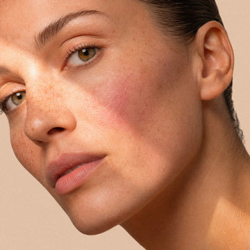 Visage d'une femme, plaque de rougeur diffuse sur la joue, peau atopique réactive