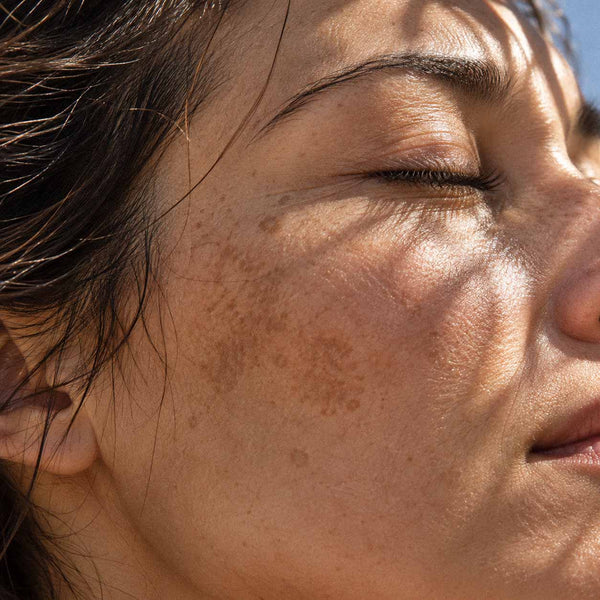 Visage d'une femme au soleil, taches pigmentaires sur la joue, exposome et vieillissement cutané