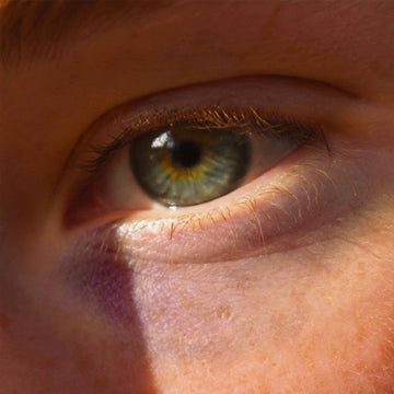 Cernes violets ou bruns : causes réelles et solutions naturelles