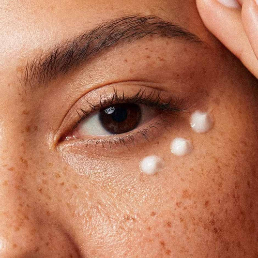 Trois gouttes de crème contour des yeux sous l'œil d'une femme aux taches de rousseur