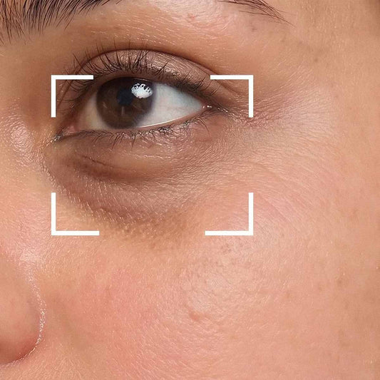 Œil d'une femme entouré d'un cadre graphique ciblant les cernes et le contour de l'œil