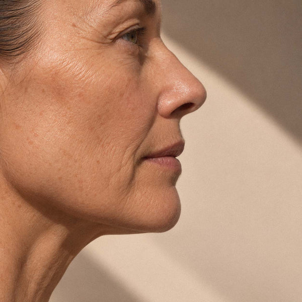 Profil d'une femme à la peau mature dans une lumière douce, sécheresse cutanée liée à l'âge