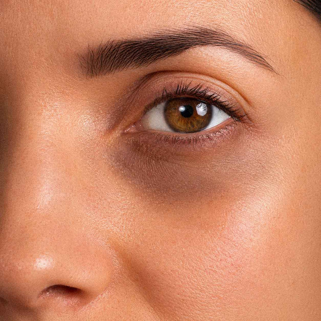 Œil brun d'une femme, cerne marqué sous la paupière, microcirculation du contour de l'œil
