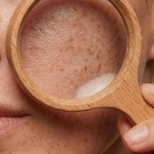 Peau et grossesse : comprendre les changements hormonaux